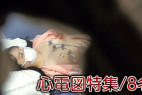 【再販】【検診/心電図】過去作ダイジェスト公開!! 美女の心電図シーン詰め合わせ!
